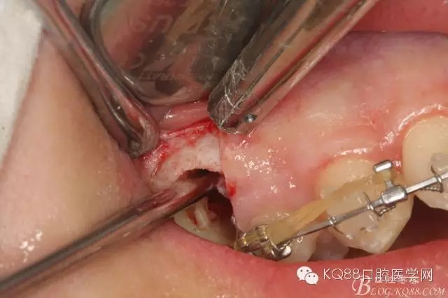 640.webp (13).jpg 640.webp (13).jpg