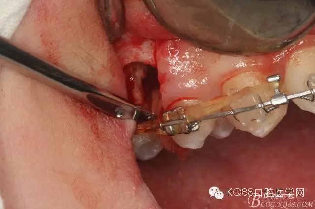 640.webp (14).jpg 640.webp (14).jpg