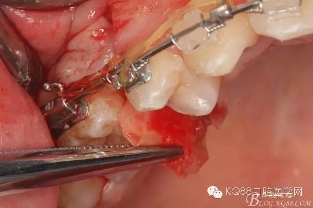 640.webp (15).jpg 640.webp (15).jpg