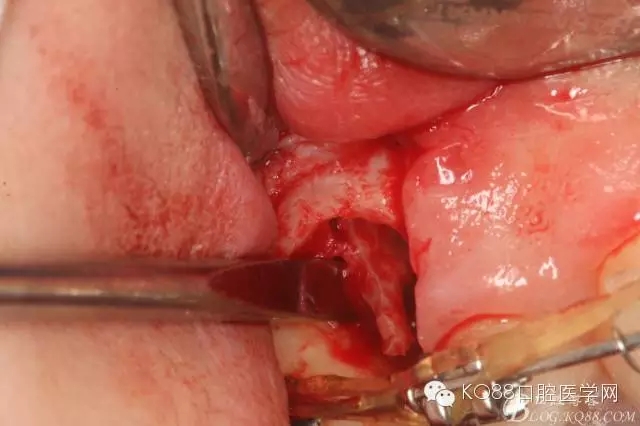 640.webp (16).jpg 640.webp (16).jpg