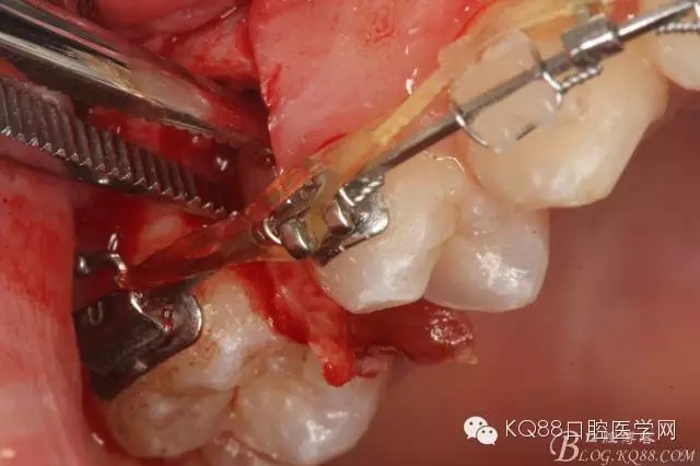 640.webp (17).jpg 640.webp (17).jpg