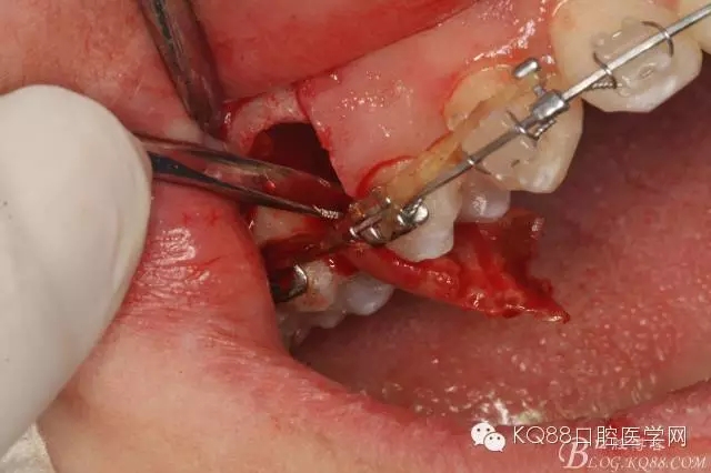 640.webp (18).jpg 640.webp (18).jpg