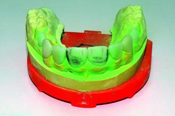 640.webp (9).jpg 640.webp (9).jpg