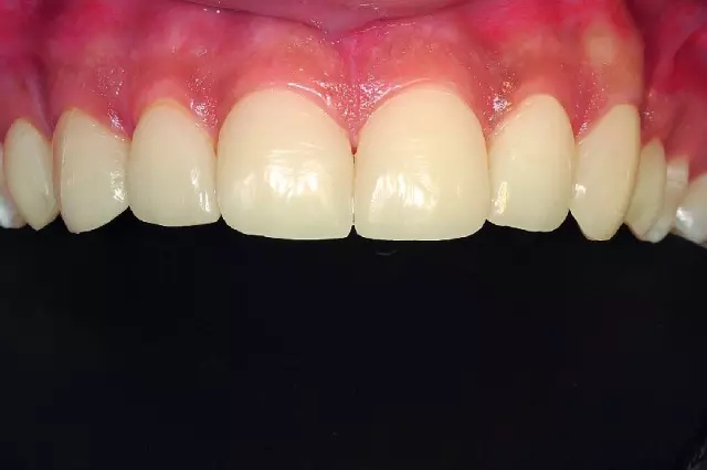 640.webp (10).jpg 640.webp (10).jpg