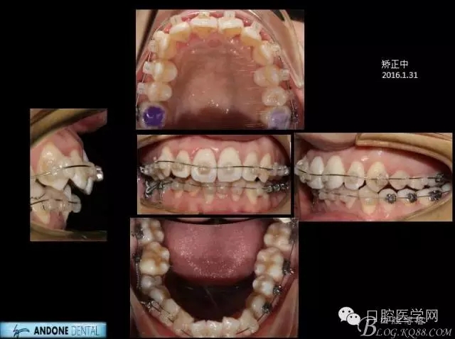 640.webp (5).jpg 640.webp (5).jpg