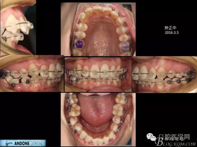 640.webp (7).jpg 640.webp (7).jpg