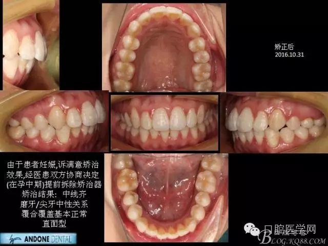 640.webp (9).jpg 640.webp (9).jpg