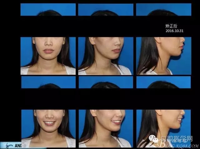 640.webp (10).jpg 640.webp (10).jpg