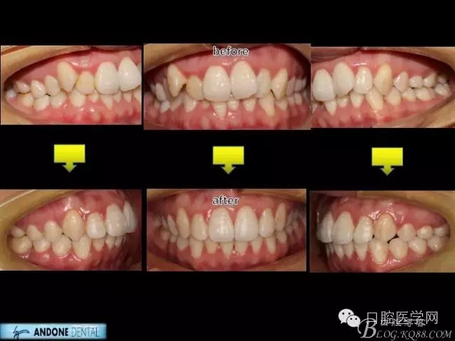 640.webp (11).jpg 640.webp (11).jpg