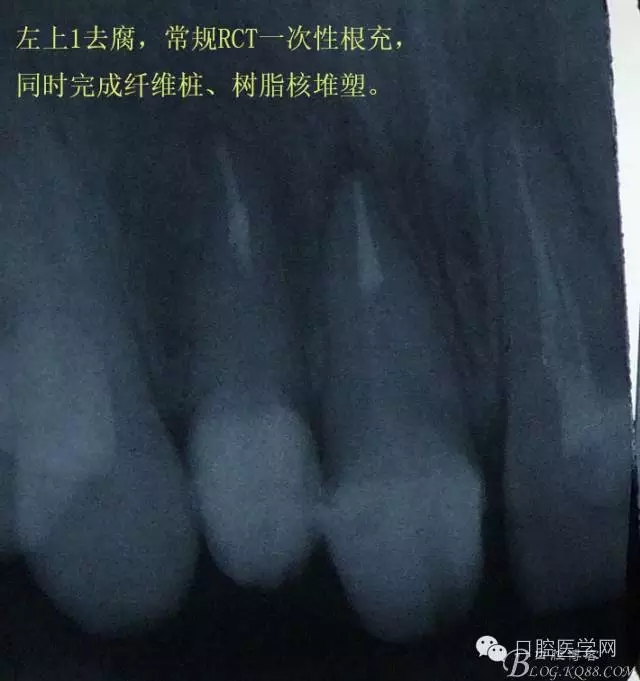 640.webp (2).jpg 640.webp (2).jpg