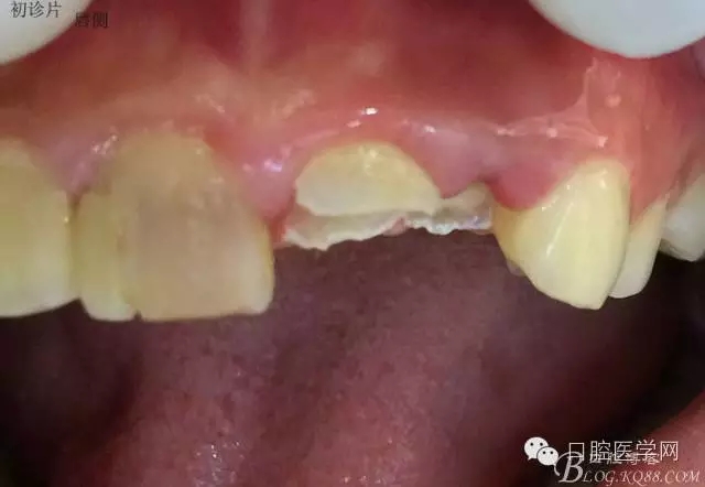 640.webp (3).jpg 640.webp (3).jpg