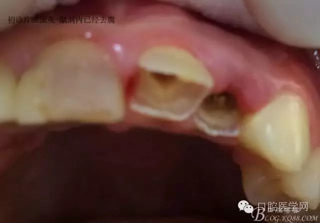 640.webp (4).jpg 640.webp (4).jpg