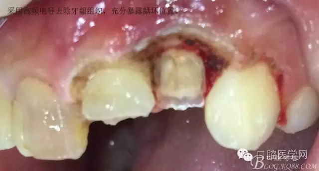 640.webp (6).jpg 640.webp (6).jpg