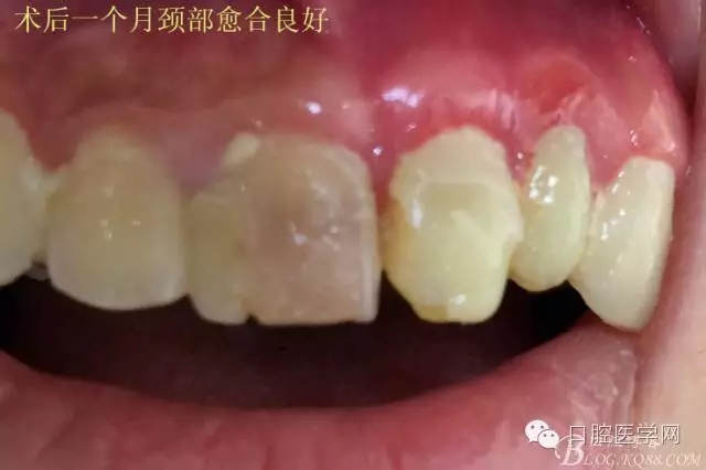 640.webp (9).jpg 640.webp (9).jpg