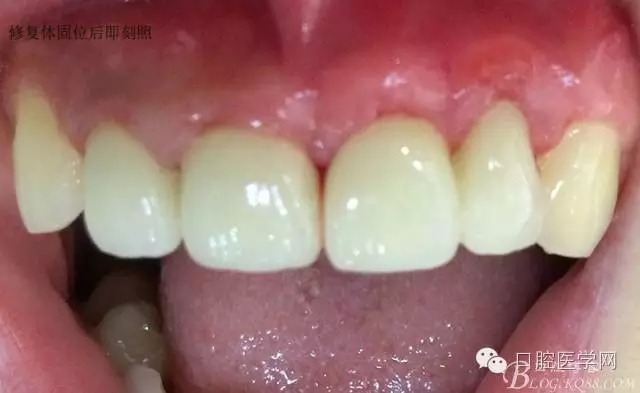 640.webp (17).jpg 640.webp (17).jpg