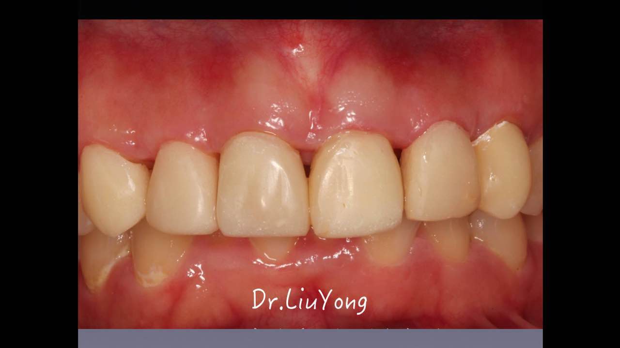 webwxgetmsgimg (2).jpg webwxgetmsgimg (2).jpg