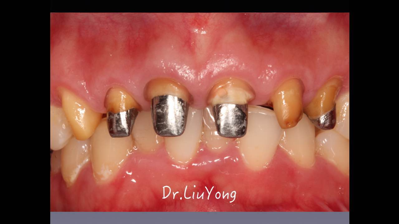 webwxgetmsgimg (3).jpg webwxgetmsgimg (3).jpg