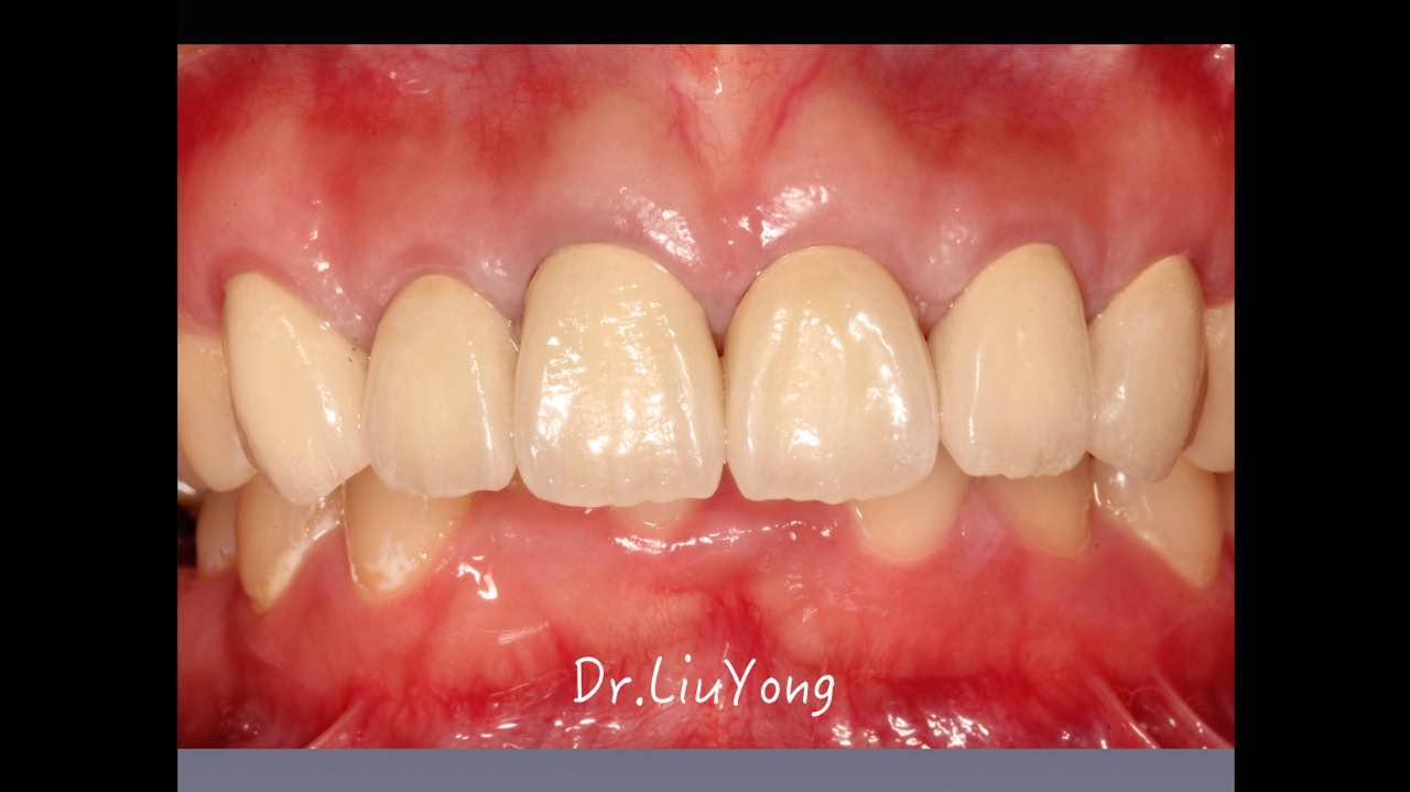 webwxgetmsgimg (4).jpg webwxgetmsgimg (4).jpg