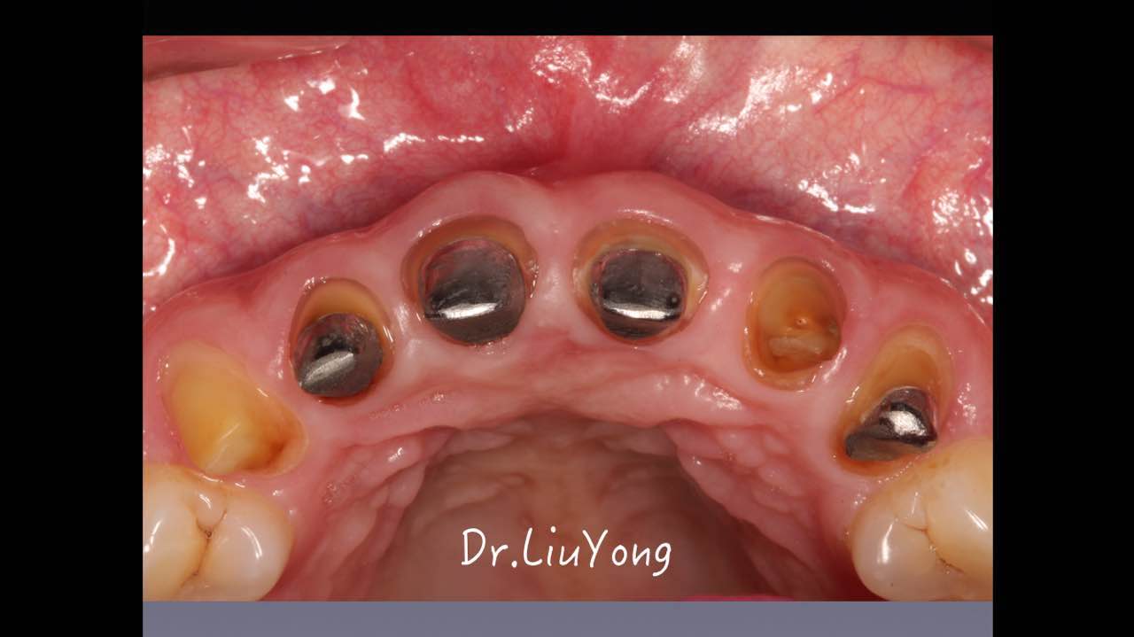 webwxgetmsgimg (6).jpg webwxgetmsgimg (6).jpg