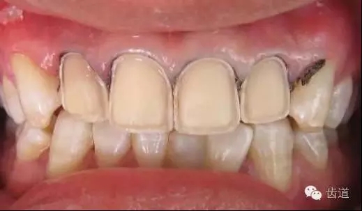 640.webp.jpg 640.webp.jpg