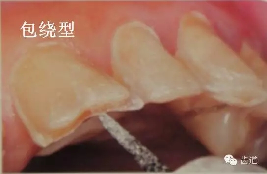 640.webp (14).jpg 640.webp (14).jpg