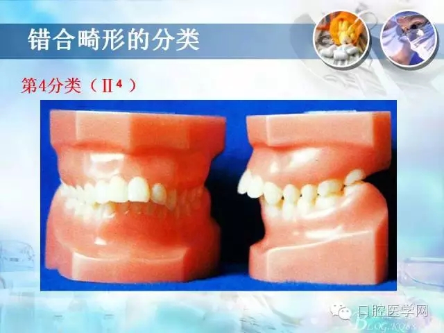 640.webp (14).jpg 640.webp (14).jpg