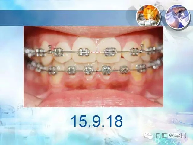 640.webp (34).jpg 640.webp (34).jpg