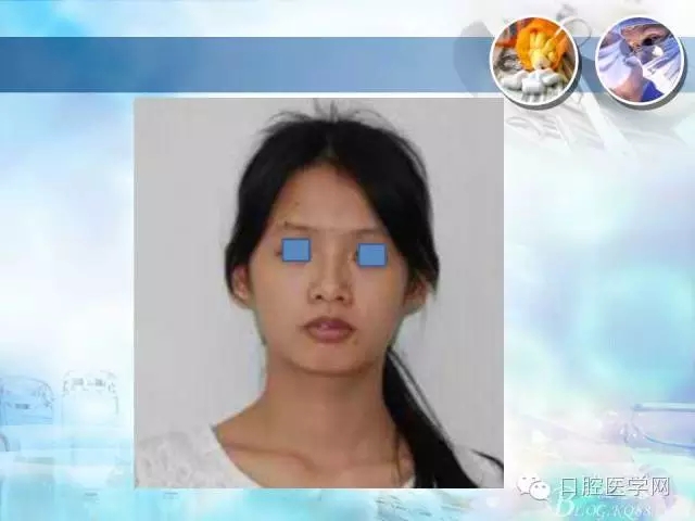 640.webp (50).jpg 640.webp (50).jpg