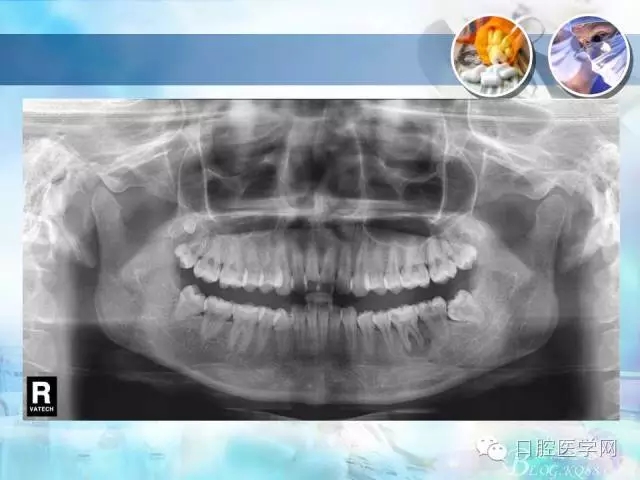 640.webp (56).jpg 640.webp (56).jpg