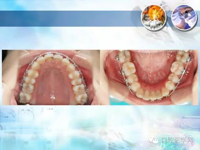 640.webp (63).jpg 640.webp (63).jpg