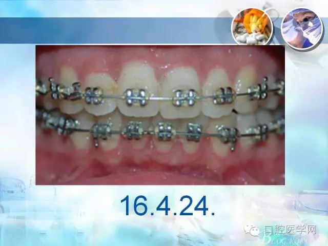 640.webp (64).jpg 640.webp (64).jpg