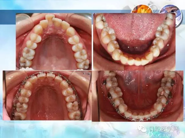 640.webp (75).jpg 640.webp (75).jpg