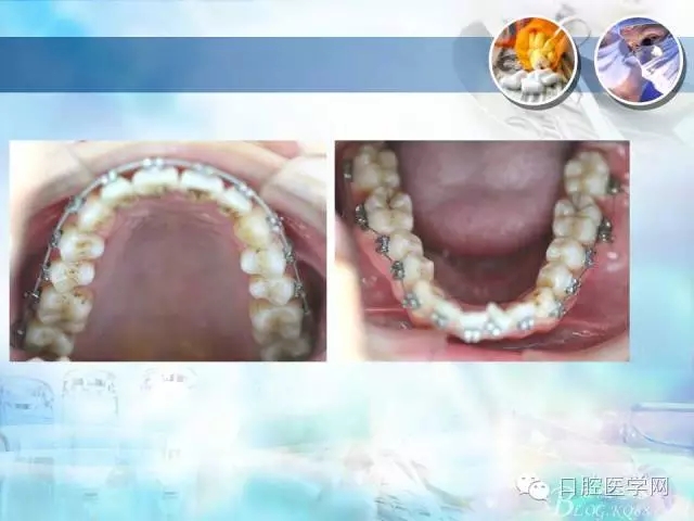 640.webp (81).jpg 640.webp (81).jpg