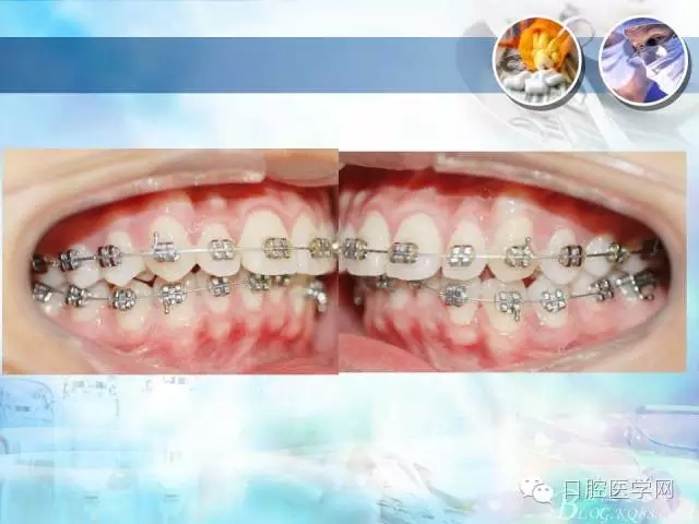 640.webp (83).jpg 640.webp (83).jpg