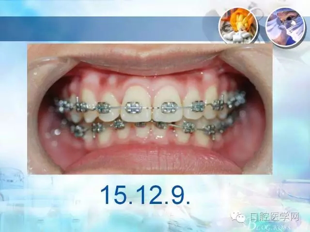 640.webp (85).jpg 640.webp (85).jpg