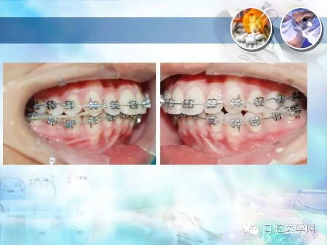 640.webp (86).jpg 640.webp (86).jpg