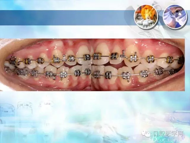 640.webp (92).jpg 640.webp (92).jpg