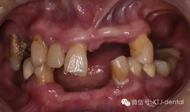 640.webp.jpg 640.webp.jpg