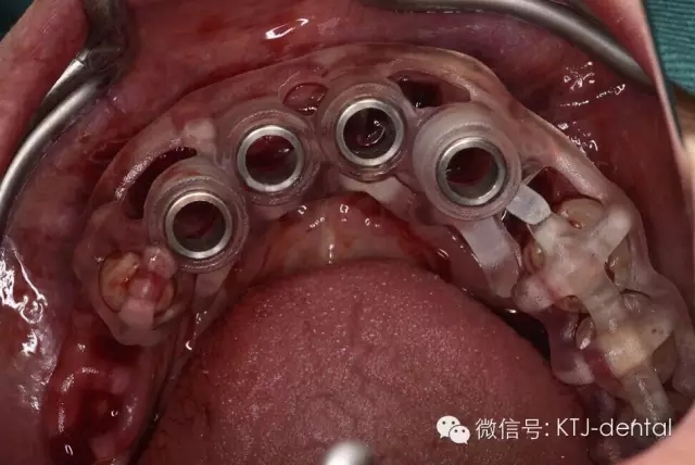 640.webp (8).jpg 640.webp (8).jpg