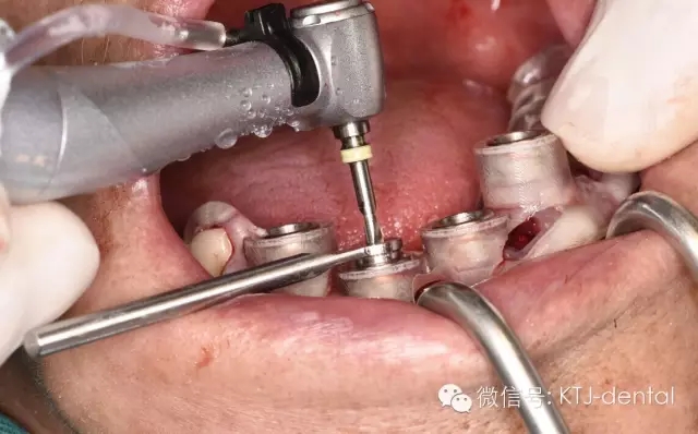 640.webp (9).jpg 640.webp (9).jpg