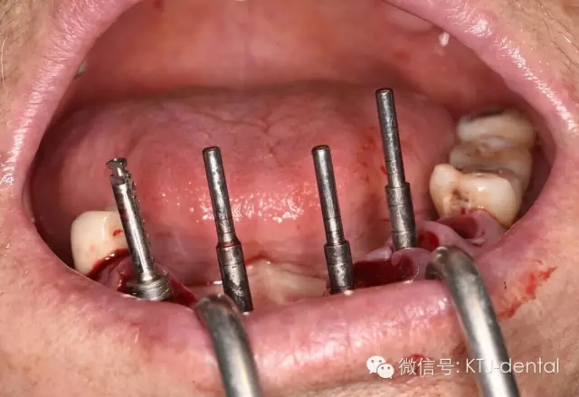 640.webp (11).jpg 640.webp (11).jpg