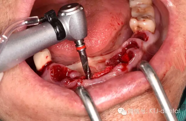 640.webp (13).jpg 640.webp (13).jpg