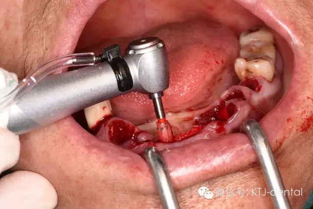 640.webp (14).jpg 640.webp (14).jpg