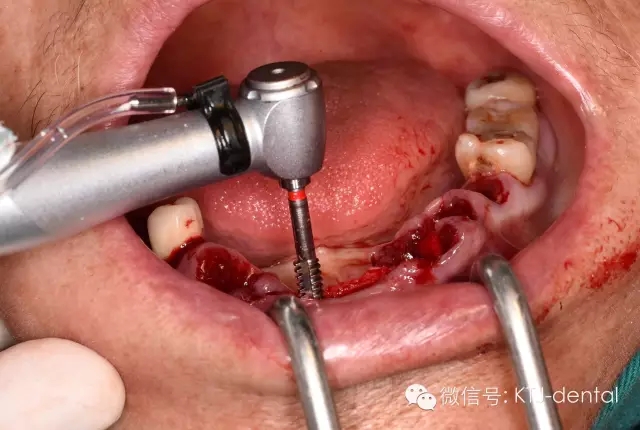 640.webp (15).jpg 640.webp (15).jpg