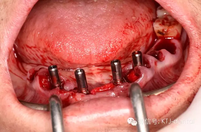 640.webp (16).jpg 640.webp (16).jpg