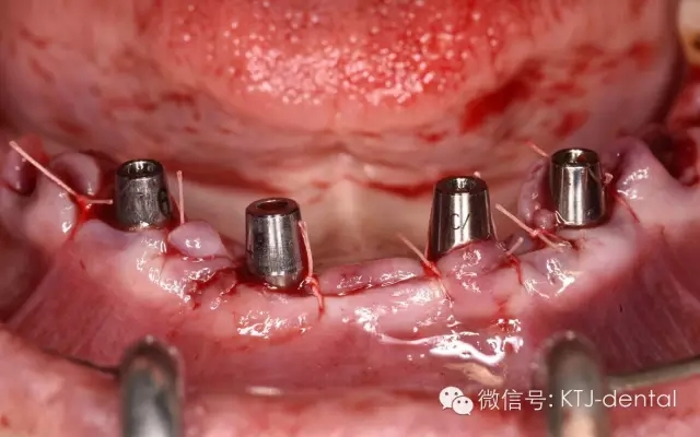 640.webp (17).jpg 640.webp (17).jpg