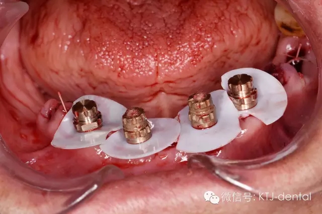 640.webp (18).jpg 640.webp (18).jpg