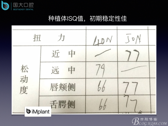 上頜竇底區(qū)域嚴(yán)重骨吸收的臨床種植案例.jpeg 上頜竇底區(qū)域嚴(yán)重骨吸收的臨床種植案例.jpeg