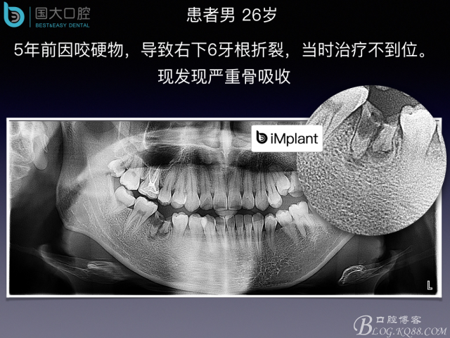 20160806124104_79312.jpeg 20160806124104_79312.jpeg