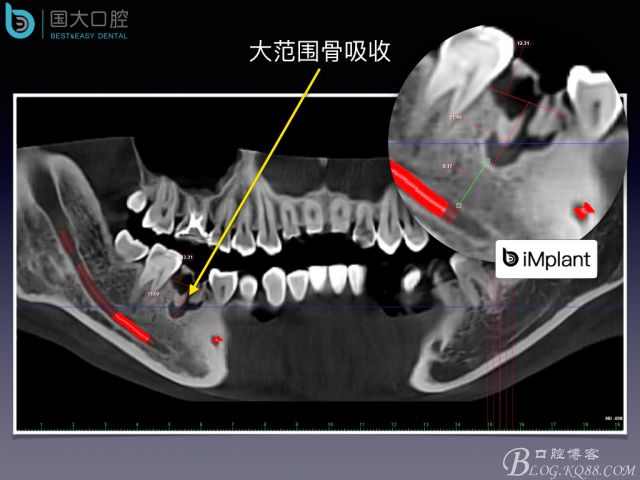 20160806124106_82542.jpeg 20160806124106_82542.jpeg